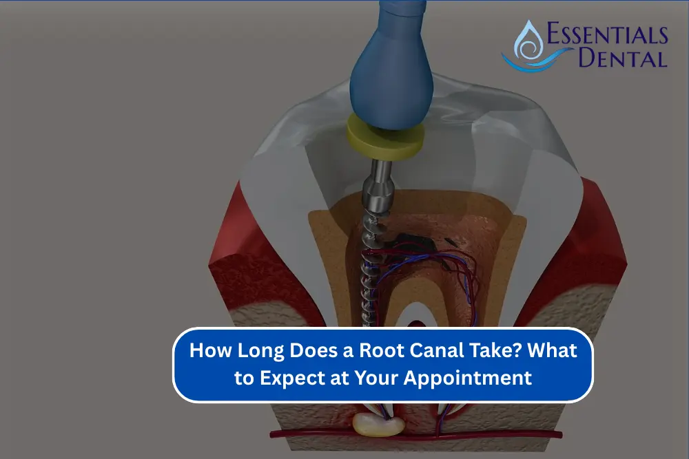 How Long Does a Root Canal Take? What to Expect at Your Appointment